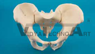 Pelvis complete, symphysis rupture